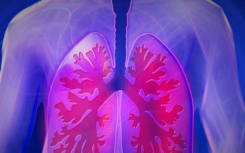 Aumolertinib 可改善 III 期非小细胞肺癌的无进展生存期